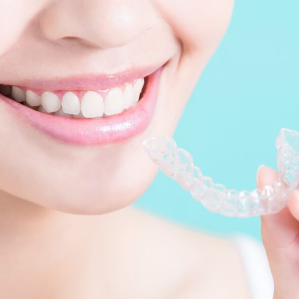 Clear Correct Invisible Braces Colac